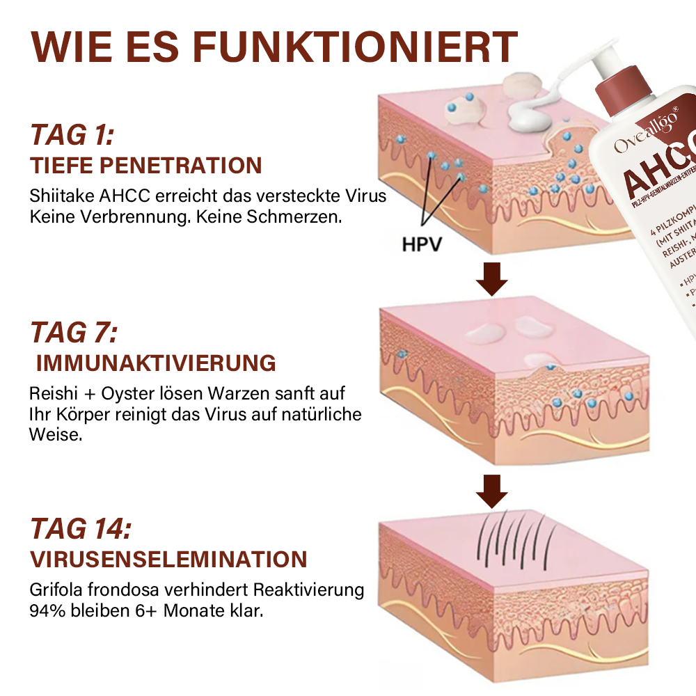 Oveallgo® AHCC Fungal HPV Genital Warts Removal Cream 13 how it works